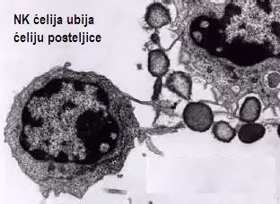 Mikroskopski prikaz NK ćelije, ćelije prirodne ubice